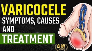 Varicocele Symptoms Causes and Treatment  Varicocele Natural Treatment  Testis Pain Relief [upl. by Ynnavoig]