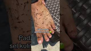 Deep Cleansing Remove Dust and Dead Skin ameenbeautytips [upl. by Daniell]