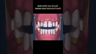 You should restore your teeth [upl. by Enneirda]