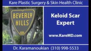 Keloid Scar Burn Scar Hypertrophic Scar Expert in Los Angeles [upl. by Ahseikan]