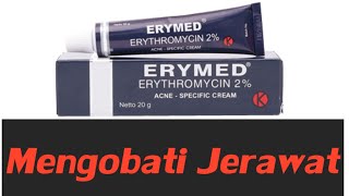 JERAWAT BATU DAPAT DIATASI DENGAN CREAM ANTIBIOTIK ERYMED CREAM 2 [upl. by Onin]