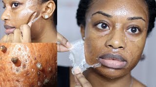 DIY Milk Blackhead Remover Peel Off Mask [upl. by Ermine516]