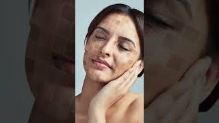 One pharmacy cream that treats 10 problems of skin skincaretips skincare skincareroutine reel [upl. by Rimat]