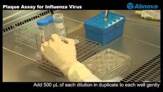 Plaque Assay for Influenza Virus [upl. by Aihsoem379]