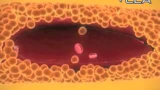 Conjugated Linoleic Acid  CLA [upl. by Nwadahs]