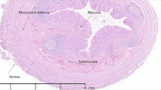 Histology of the Appendix [upl. by Salene]