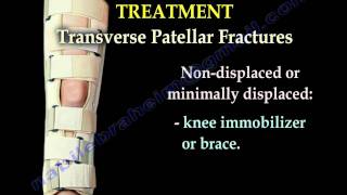 Patellar Fractures  Everything You Need To Know  Dr Nabil Ebraheim [upl. by Hnid]