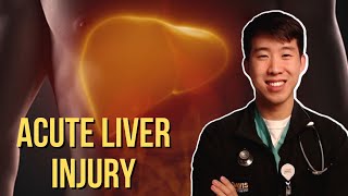 How to Evaluate Acute Liver Injury Hepatocellular vs Cholestatic Made Easy [upl. by Melar784]