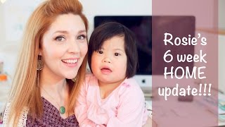 Rosies 6 week UPDATE  China Adoption Story [upl. by Eihtak]