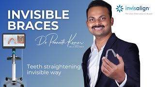 Invisible Braces Treatment In India  Invisalign aligners  Complete process [upl. by Eleinad837]