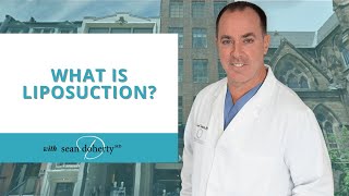 What Is Liposuction [upl. by Gisele452]