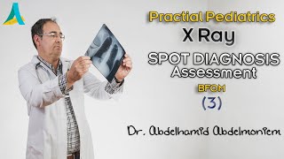 Pediatrics Radiology  X Ray Spots Revision 3  DrAbdelhamid Abdelmoniem [upl. by Enirhtak]