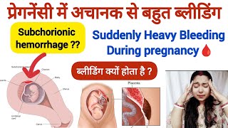 प्रेगनेंसी में ब्लीडिंग किस कारण से होता है  Heavy Bleeding During Pregnancy  Pregnancy Tips [upl. by Magnolia789]