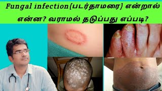 AIDS symptoms in TamilAIDS in Tamilhiv explained in tamilaids explained tamilhiv symptoms tamil [upl. by Alleuqram493]