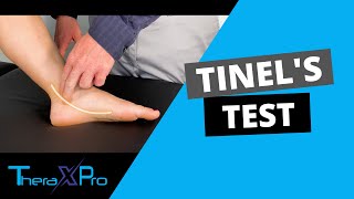 Tinels Sign  Tarsal Tunnel Syndrome [upl. by Orat263]