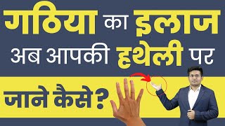 गठिया के इलाज के लिए Acupressure Points  Rheumatoid Arthritis  Bharat Homeo Joints Treatment [upl. by Kred]