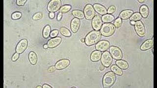 Activité B21 observation microscopique des levures de boulanger [upl. by Latsyrcal]