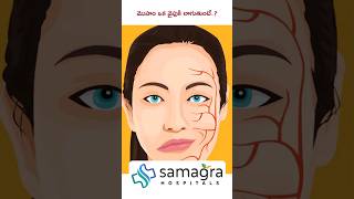 Understanding Hemifacial Spasm HemifacialSpasm DrKNeeraja Neurologist SamagraHospitals Guntur [upl. by Aidnama351]