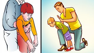 How to Help a Choking Child or Adult Everyone Must Know [upl. by Nilyam113]