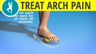 Arch Foot Pain  Problems with Plantar Fasciitis [upl. by Merow]