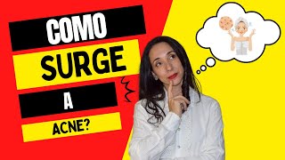 Como Surge a Acne [upl. by Megdal]