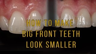 What to do if one tooth looks big and long [upl. by Godden]