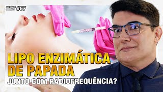 Lipo Enzimática de Papada junto com Radiofrequência Funciona  Sua Dúvida Vira Vídeo 57 [upl. by Onaicilef]