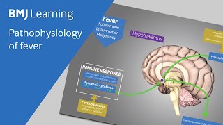 Pathophysiology of fever explained [upl. by Salamone]