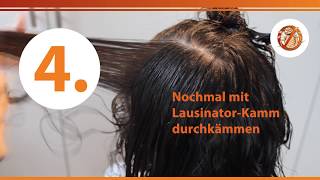 KopfläuseVideo Läuse amp Nissen im Haar auf dem Kopf erkennen – aktuelle Studienlage [upl. by Ttirrej]