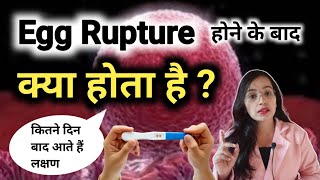 egg rupture hone ke kitne din baad pregnancy consive hoti hai  IndependentChashmish1 [upl. by Drofdeb]