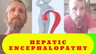 Hepatic Encephalopathy Strikes Back  Liver Cirrhosis Vlog [upl. by Ennaj614]