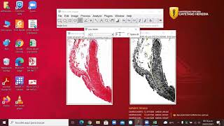 Análisis de imágenes Tricrómica de Masson con Fiji ImageJCuantificación de colágenoMétodo II 2021 [upl. by Viviene]
