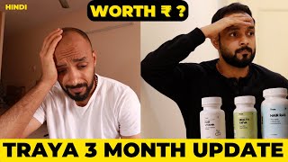 ✅ Traya Hair Regrowth👩‍🦲3 Month Progress Update 👉 My Honest Opinion 🟡 from hair loss to Thicker Hair [upl. by Alahs]