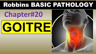 Ch20  GOITRE Pathology  Robbins Pathology  Dr Asif Lectures [upl. by Arracahs]