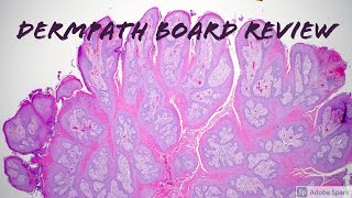 Dermatopathology Board Review for Dermatology Pathology Dermpath 19 Classic Cases [upl. by Bessy]