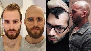 BALDING MEN EMBRACE GOING BALD  BaldCafe Head Shave INSPIRATION [upl. by Rentschler]