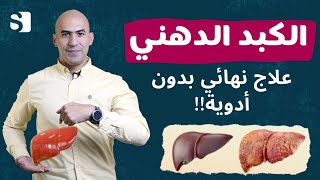 الكبد الدهني  علاج الكبد الدهني بدون ادويه  شفاء الكبد الدهني تماما [upl. by Atteuqehs]