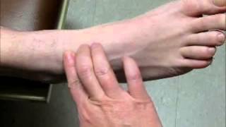 Sample Video  Palpate for Dorsalis Pedis Pulse [upl. by Erdnassac]