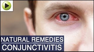 Conjunctivitis Pink Eye  Natural Ayurvedic Home Remedies [upl. by Enoid24]