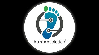 Back on Facebook Coaching for Bunions Hallux Limitus Hammer Toes Tailors Bunion [upl. by Jacob123]