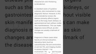 Systemic Sclerosis sine Scleroderma rheumatology scleroderma sclerosis [upl. by Tenom]