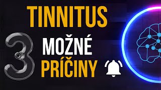 Tinnitus  3 možné príčiny zvonenia v ušiach  TOP [upl. by Savina]