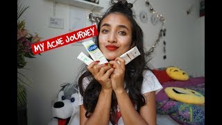 MY ACNE JOUREY  ISOTRETENOIN AND SELF LOVE [upl. by Ahsimet185]