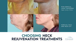 Factors in Choosing NonSurgical Neck Treatment or a Surgical Neck Lift [upl. by Ellenwad]