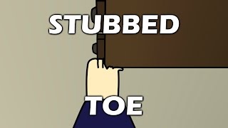 Stubbed Toe [upl. by Dekow]