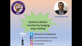 Epidural catheter insertion by hanging drop method [upl. by Adnelg10]