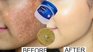 Vaseline and lemon for skin whitening  Vaseline for pigmentation and dark spots on face [upl. by Yniattirb]