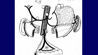 GASTROENTEROLOGIE cancer de lestomac 2 [upl. by Nonad]