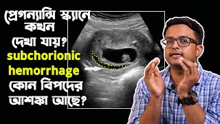 subchorionic hemorrhage  কেন হয়  এর থেকে কি মিসক্যারেজ হয়  The Bong Parenting [upl. by Eldon]