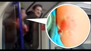 WOMAN BITES MAN S ARM IN LONDON DISGUSTING [upl. by Coleen]